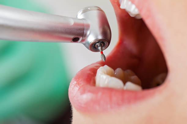 Best Emergency Gum Pain Relief  in East Lake Orient Park, FL